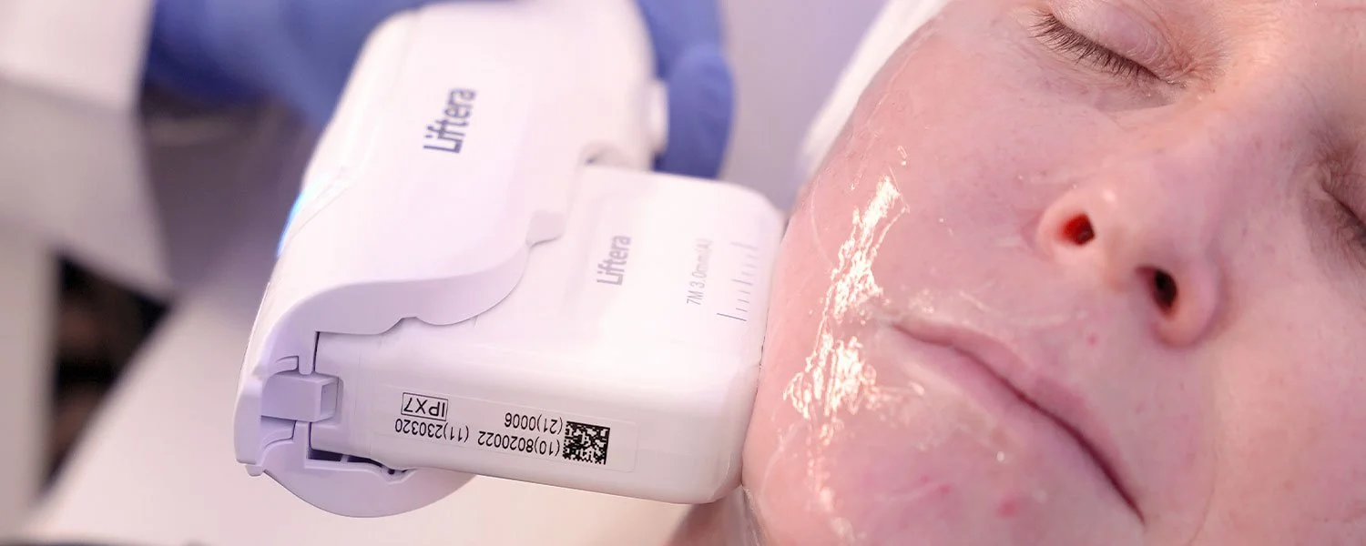 Athena Liftera HIFU Non Surgical Facial Lifting