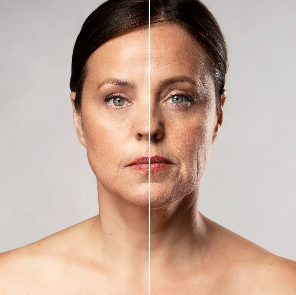 The Honest Guide to Anti-Wrinkle Injections: What They Do, What They Don't, and Why the Difference Matters