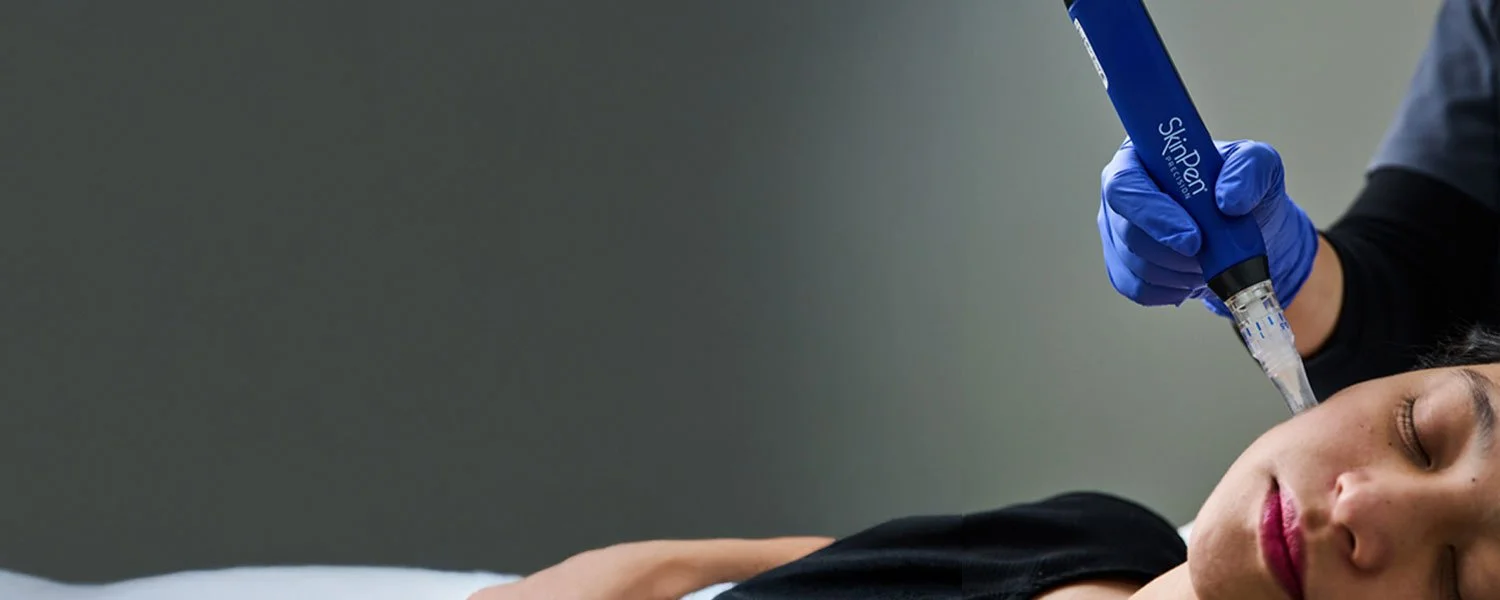 Athena Skinpen Microneedling