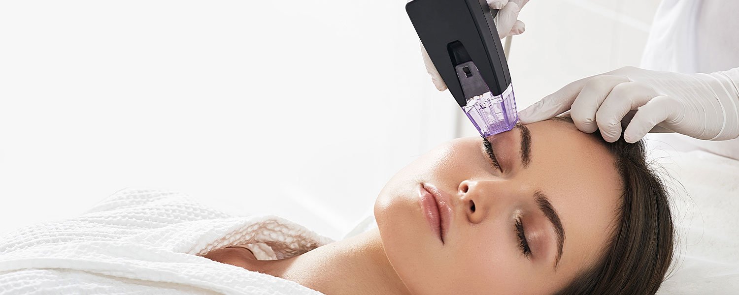 Athena Morpheus 8 Microneedling