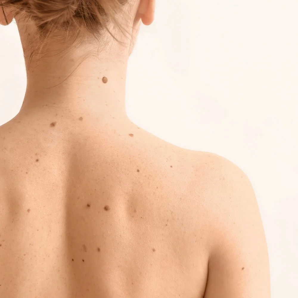 Clinical Dermatology