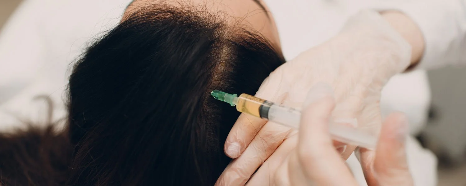 Athena Exosomes for Hair Loss