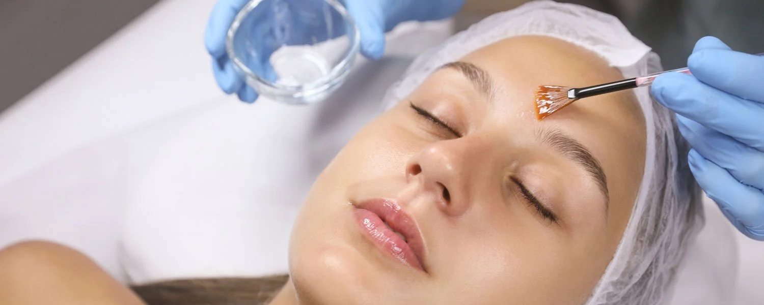 Athena Chemical Peel