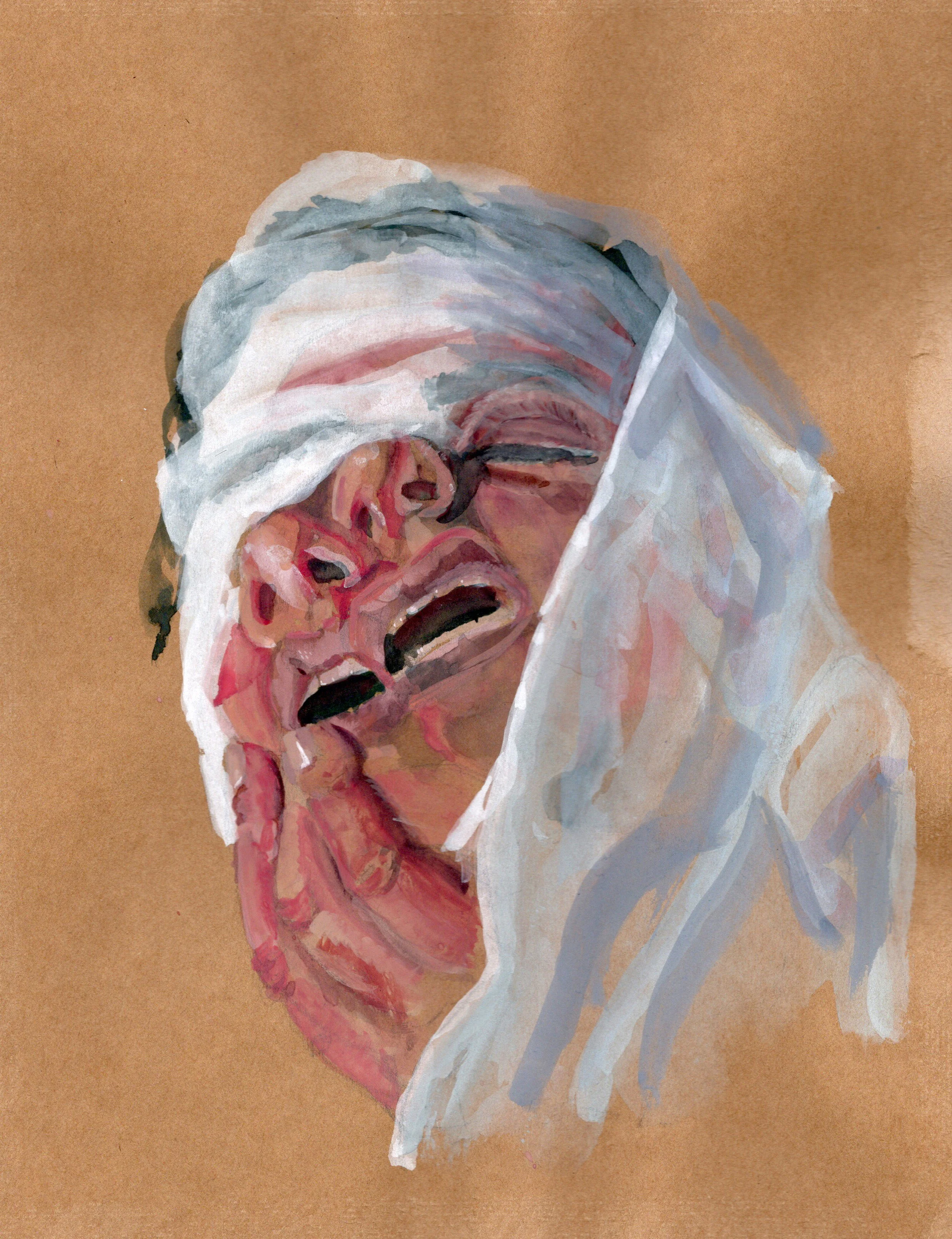 A person with skin and hair covered in bandages, with a distressed facial expression, holding their face with hand, in watercolor style.