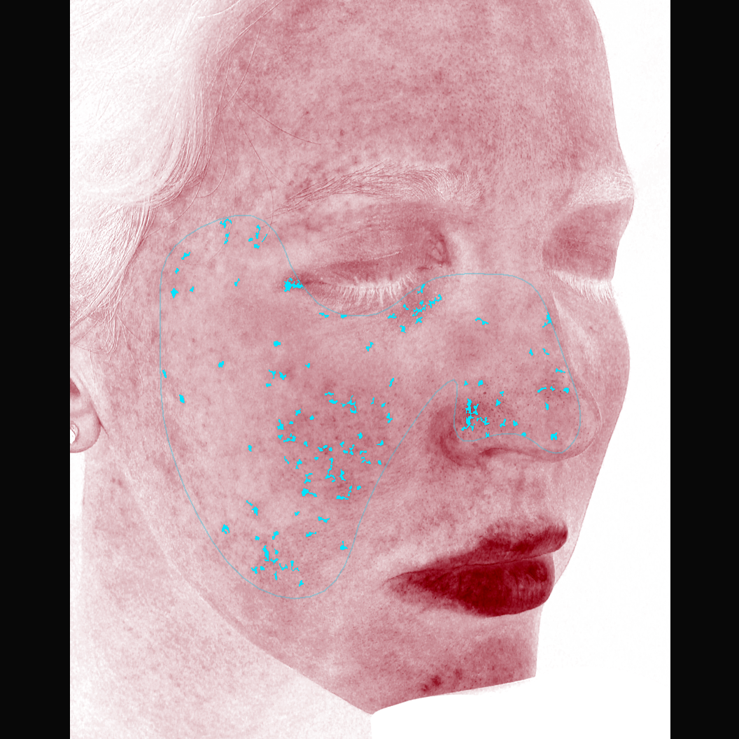 VISIA and our VISION