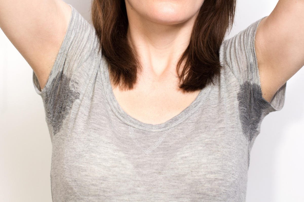 Ask Dr. Peirson – How do you treat excessive sweating?