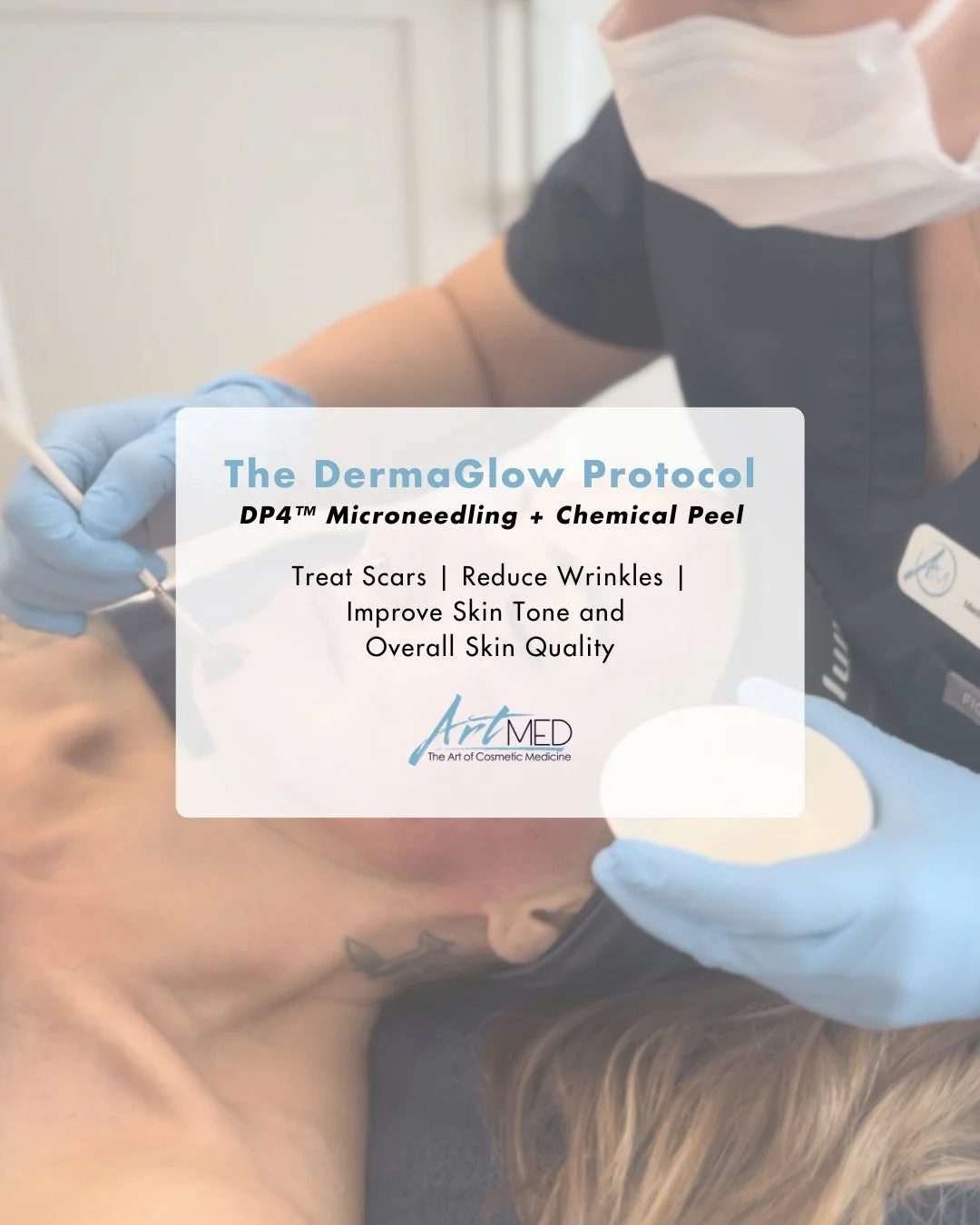 ✨ Introducing DermaGlow Microneedling at ArtMed.

This advanced microneedling protocol pairs traditional microneedling with carefully selected, medical-grade topical ingredients to enhance skin rejuvenation. By creating controlled micro-channels in t