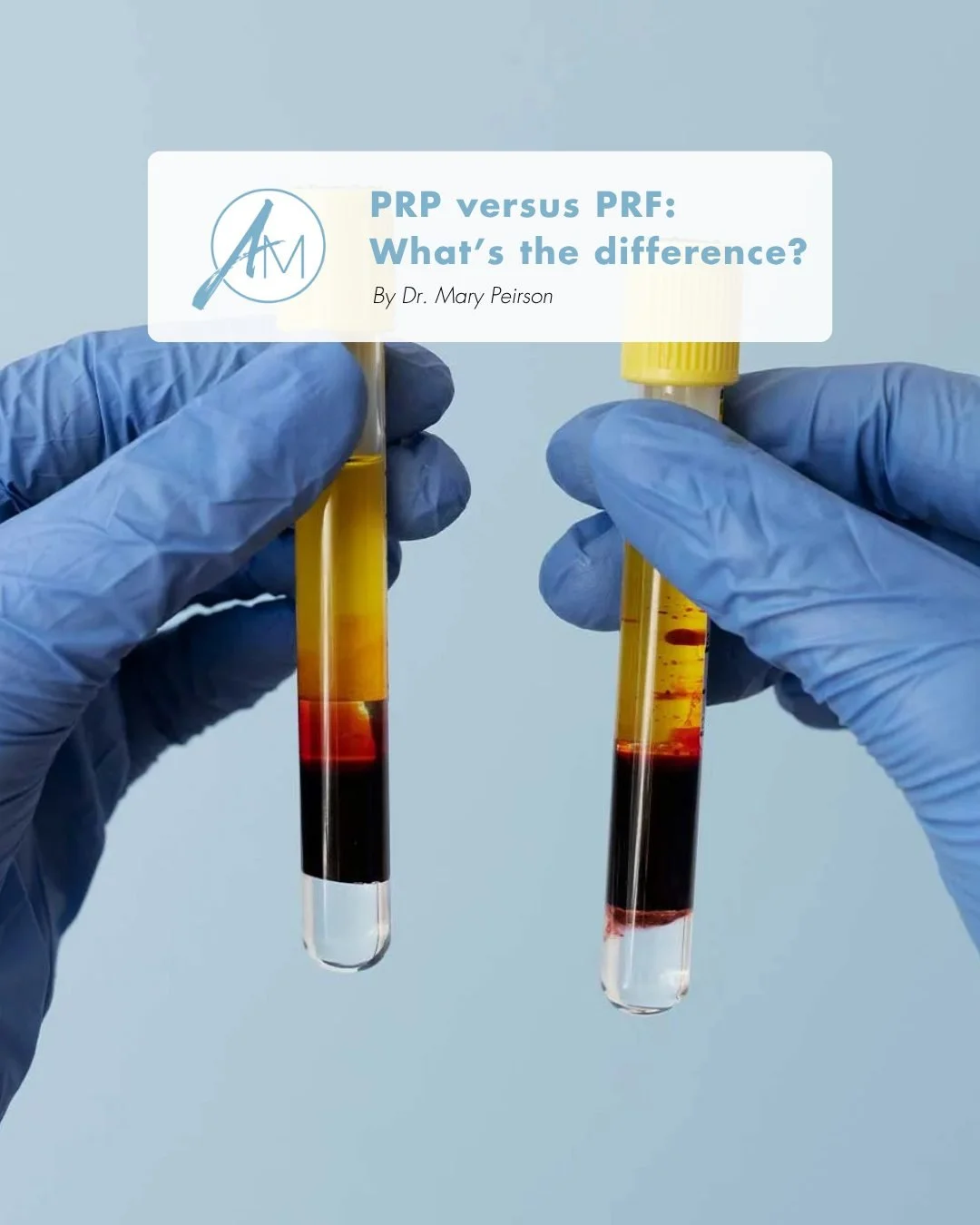 PRP vs PRF&hellip; what&rsquo;s the difference? 🩸

Both PRP (Platelet-Rich Plasma) and PRF (Platelet-Rich Fibrin) use your body&rsquo;s own natural growth factors to support rejuvenation and healing, but they are processed differently and may be rec