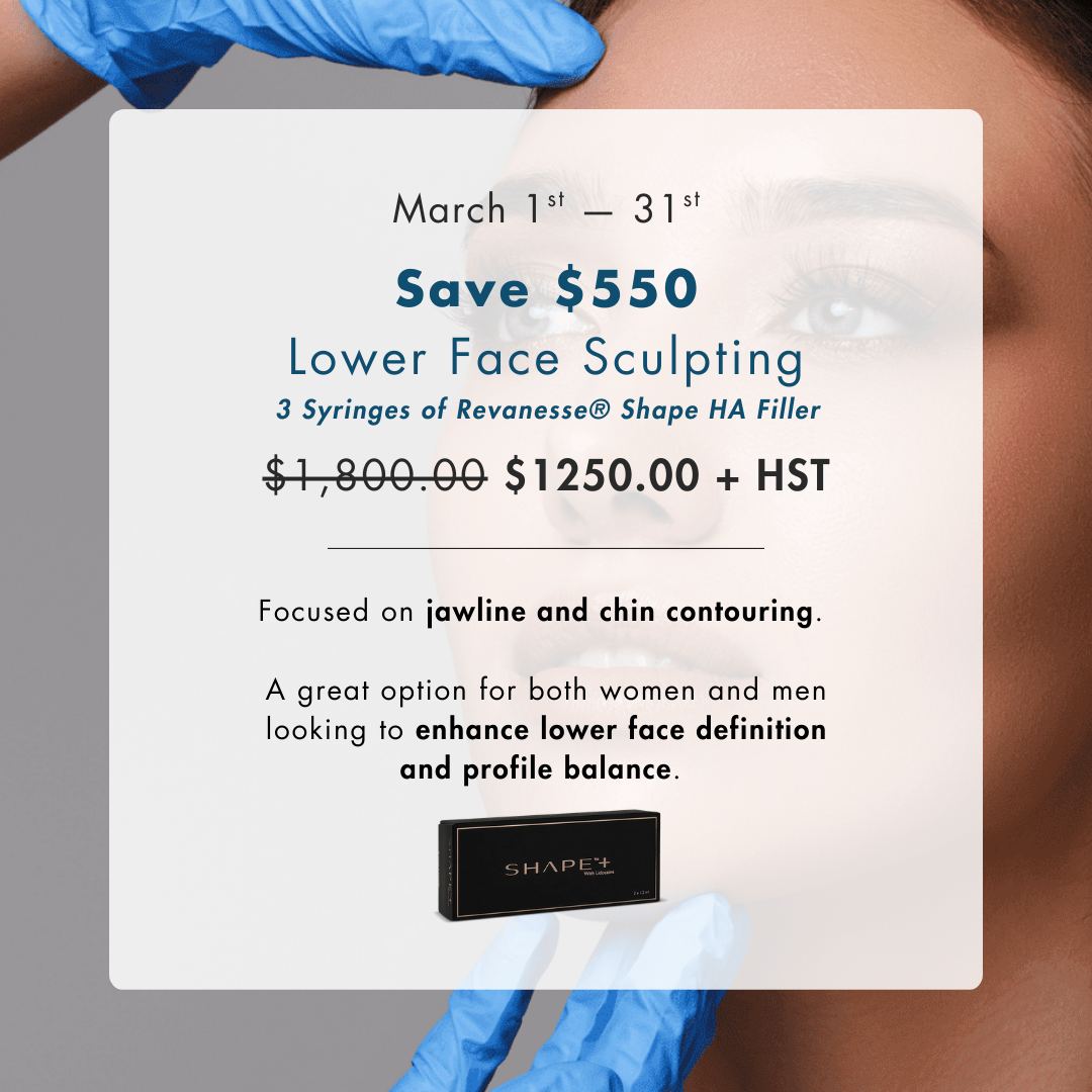 Revanesse® Shape Dermal Filler Promo – 3 Syringe Lower Face Sculpting Package