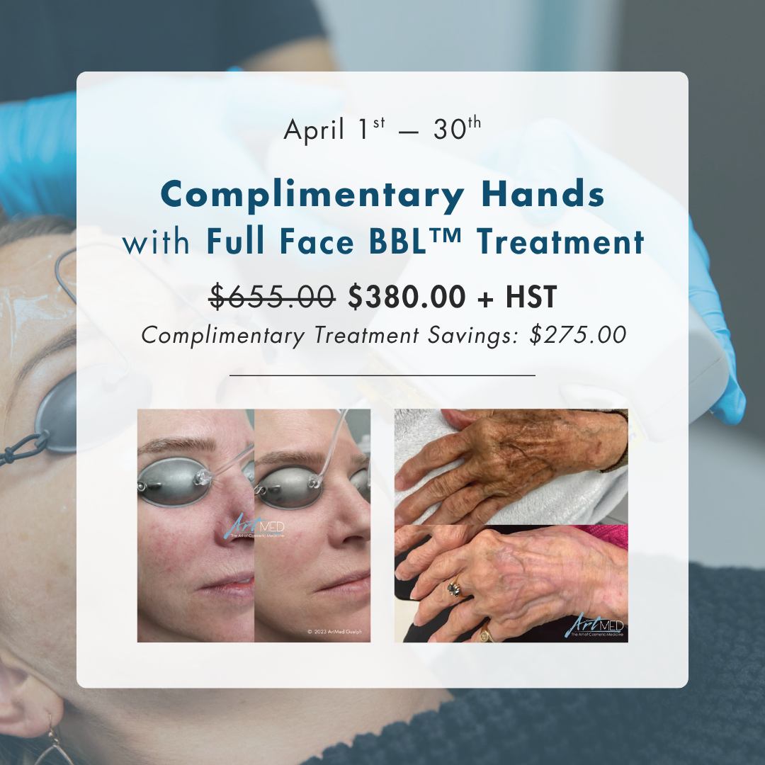 Complimentary Hands with Full Face BBL™ Treatment