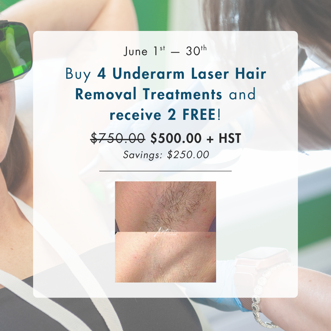 Underarm Laser Hair Removal: Buy 4, Get 2 FREE
