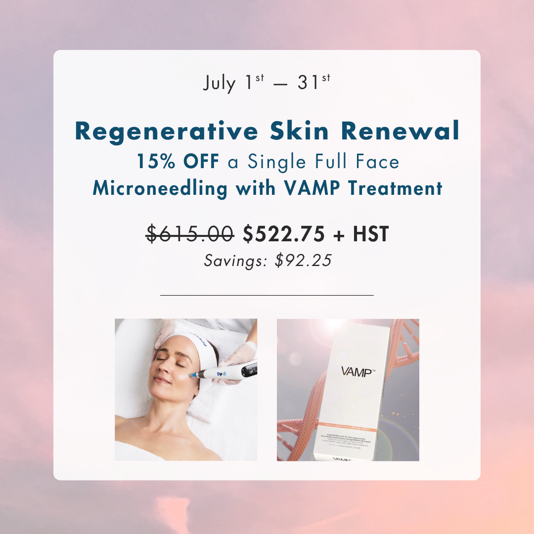 Regenerative Skin Renewal: 15% OFF Microneedling with VAMP™