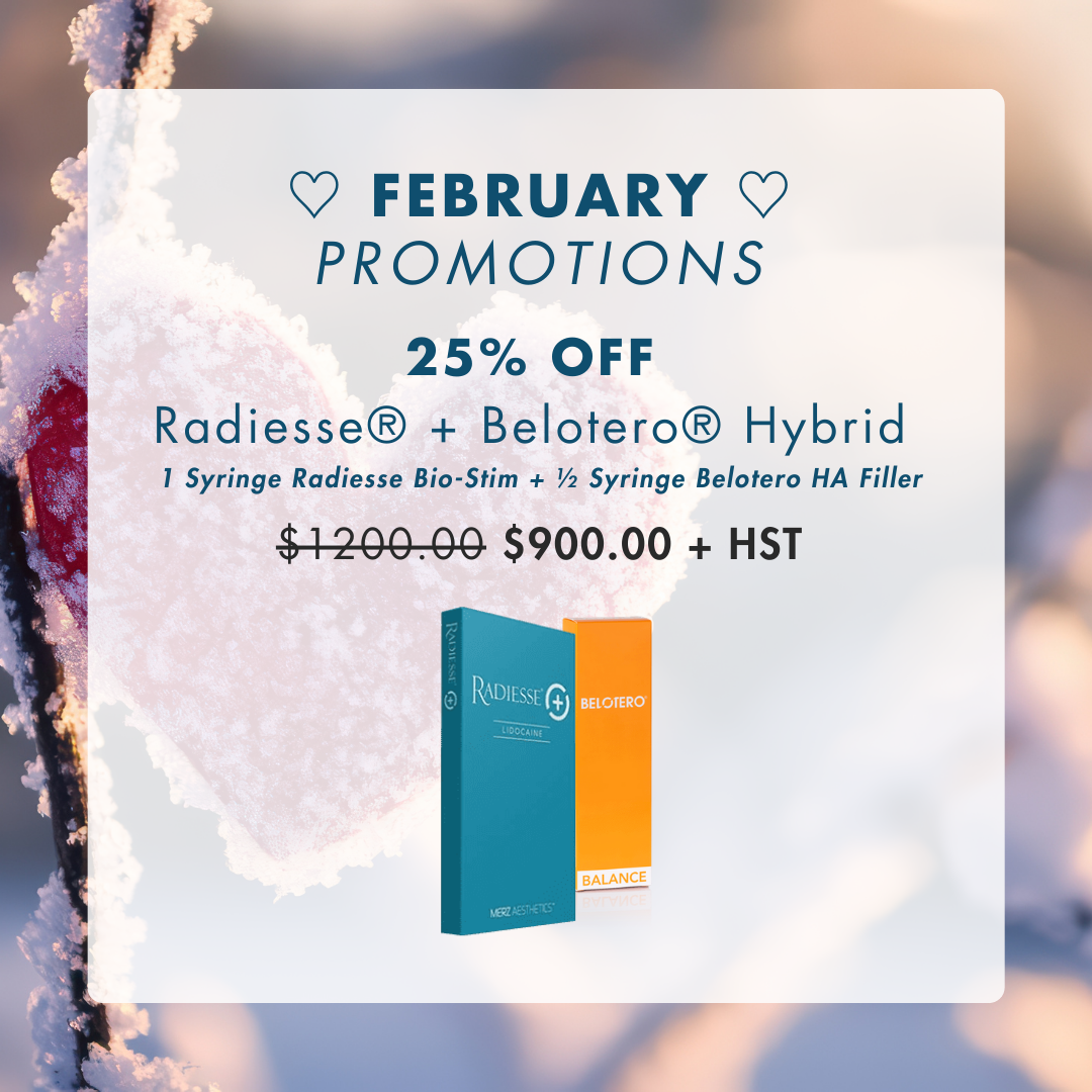 25% OFF: Radiesse® + Belotero® Hybrid Filler | February Offer