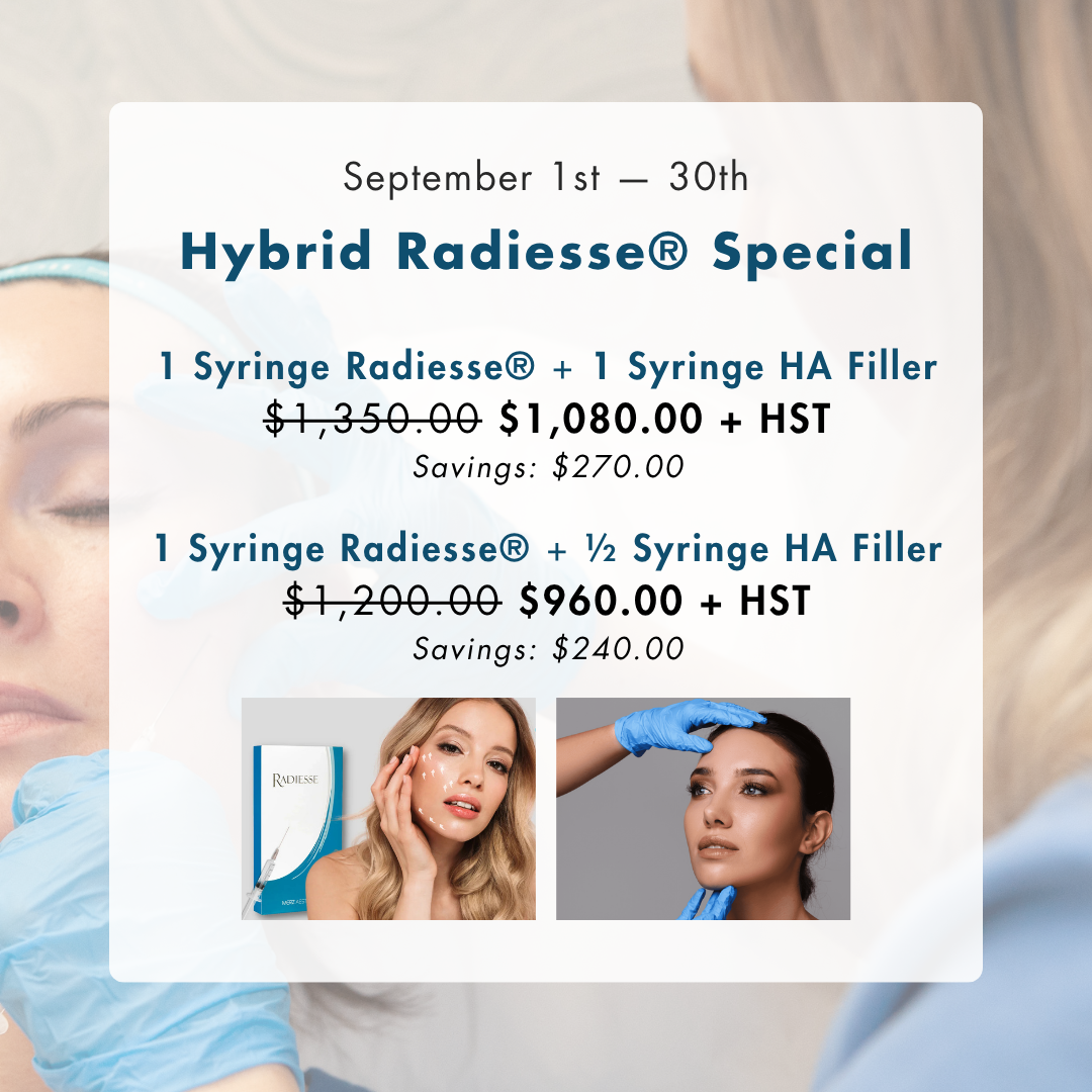 Hybrid Radiesse® Special – Save 20%
