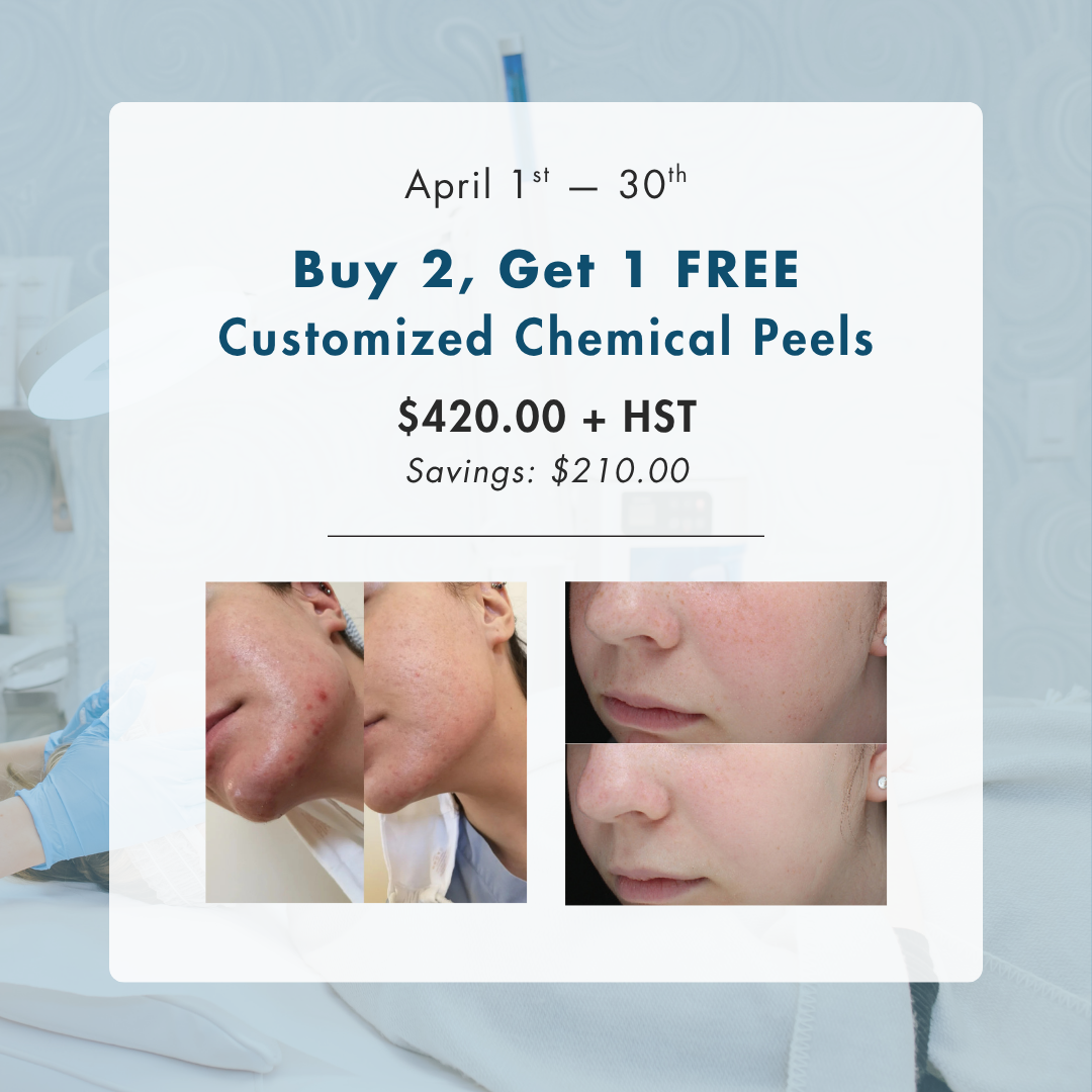 Buy 2, Get 1 FREE Chemical Peels
