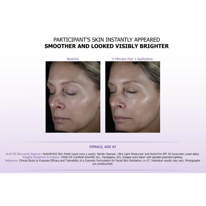 Resurface5.webp