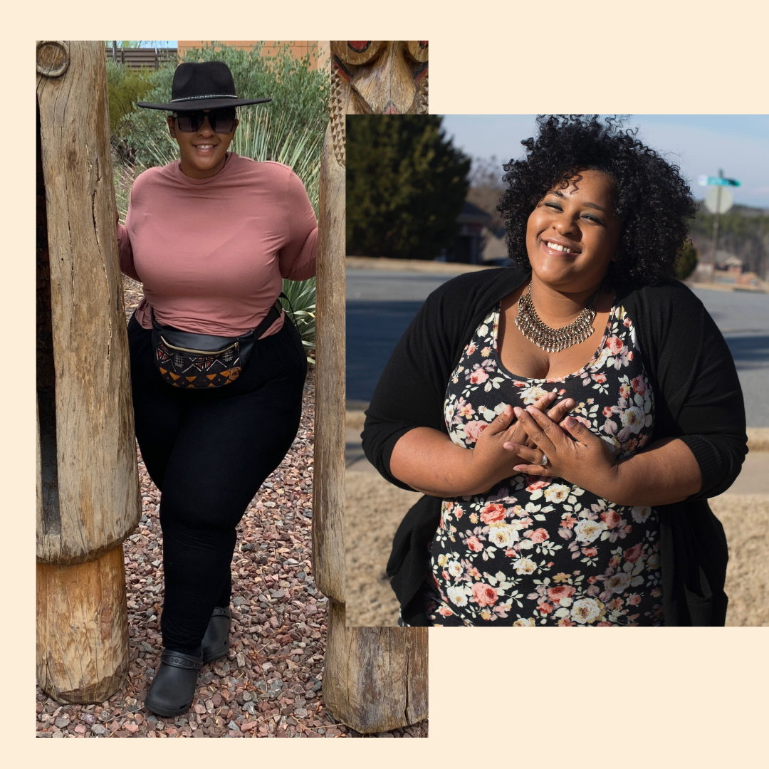 Weight Loss Surgery — Cat B.