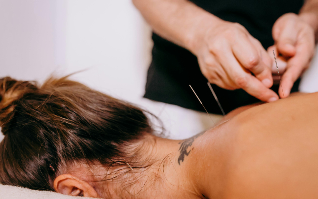 Acupuncture &amp; Microcurrent Therapy: Gentle Tools for Pain, Stress, and WholeBody Balance