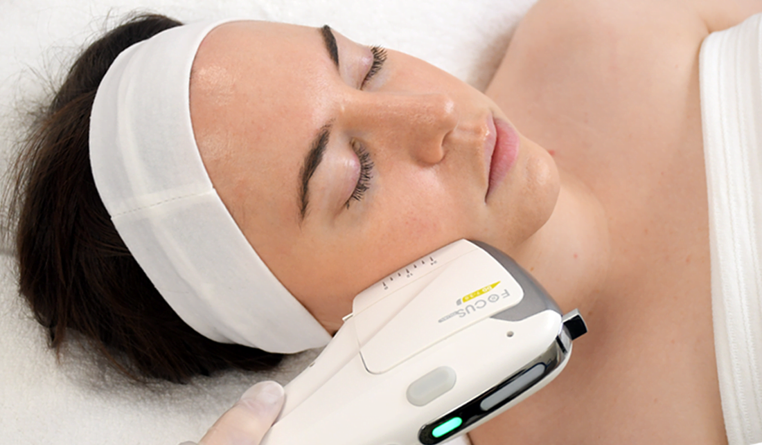 Focus-Dual-HIFU-Handpiece-on-Womans-Face.png