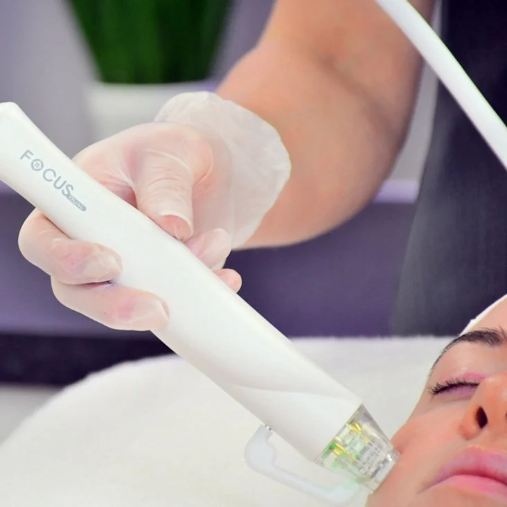 Focus-Dual-RFM-Handpiece.jpg