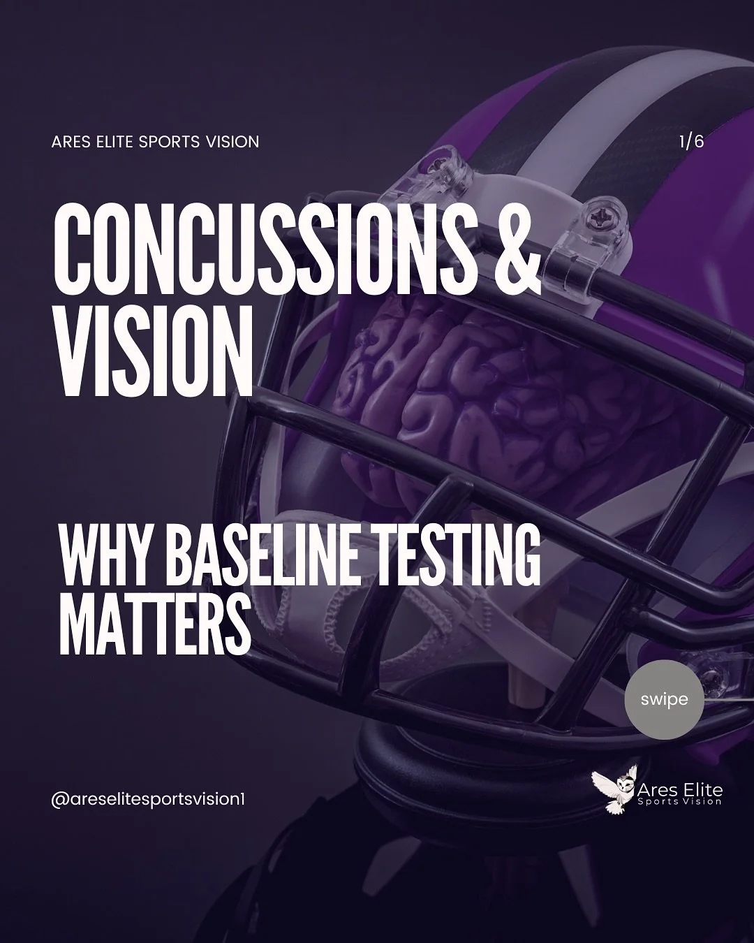 Baseline testing matters more than people realize.
When an athlete gets a concussion, you need to know what their brain and vision looked like before the hit&hellip;not just guess.

A baseline gives us their normal so we can measure their recovery an