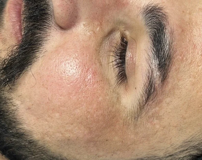 Best Skin Clinic Near Me