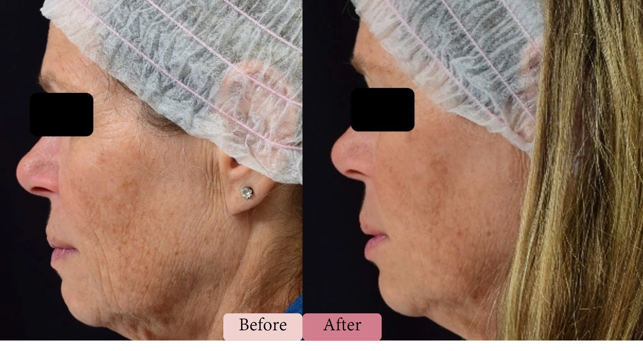 dermatologist Oakville, Burlington