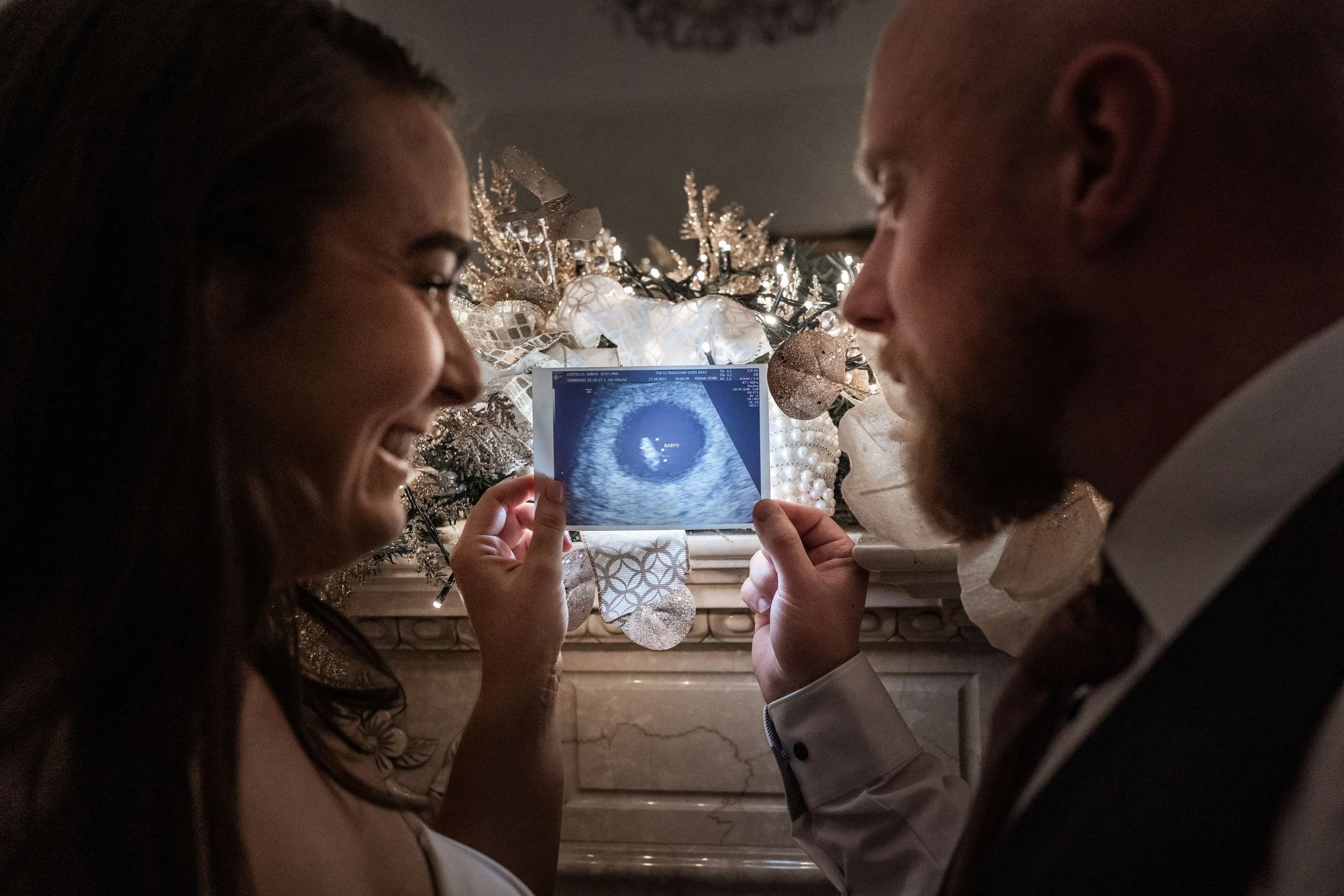 35M00113.jpgPaolo Furlan Photography- Wedding Photographer Ireland- Summerhill House Weddings- Luxury Weddings- Westgrove Hotel Wedding Venue- West Grove Hotel- Wedding Photography- Paolo Photography- .jpg