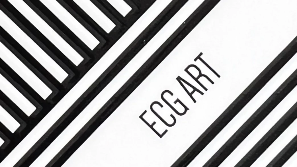ECG Art