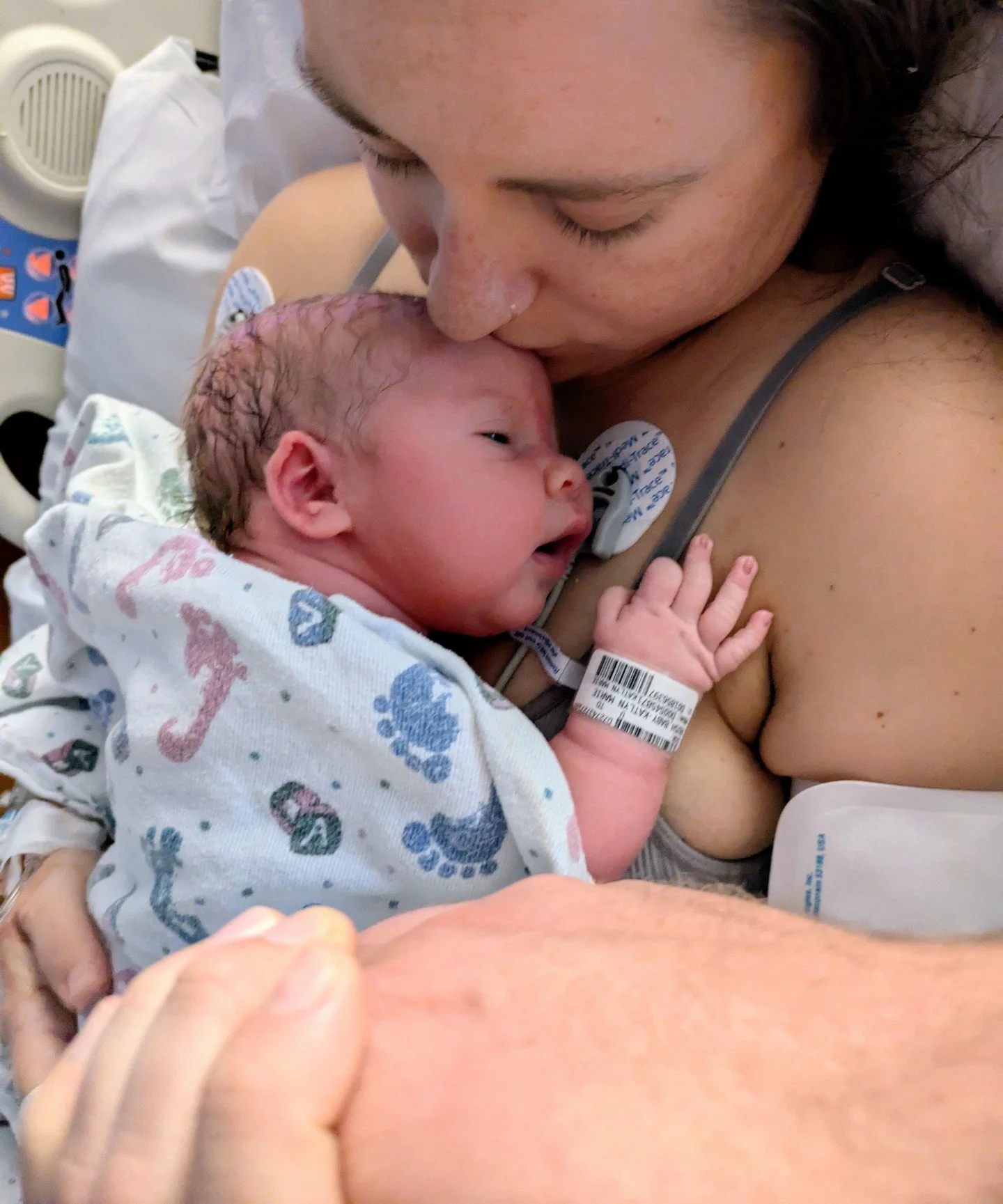 Katie wanted to trial a vaginal birth after cesarean section. She was courageous and had to dig deep when the baby's heart rate was no longer tolerating the labor trial, but was well supported by her doula, husband, and birth team with the decision t