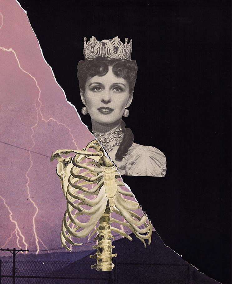 Februllage - xray.png