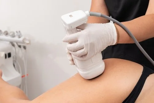 Liposonix hip.jpg