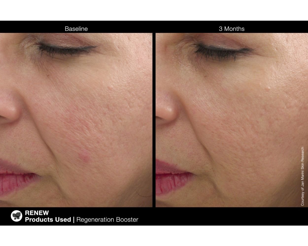 regenerationbooster_6_hd.jpg