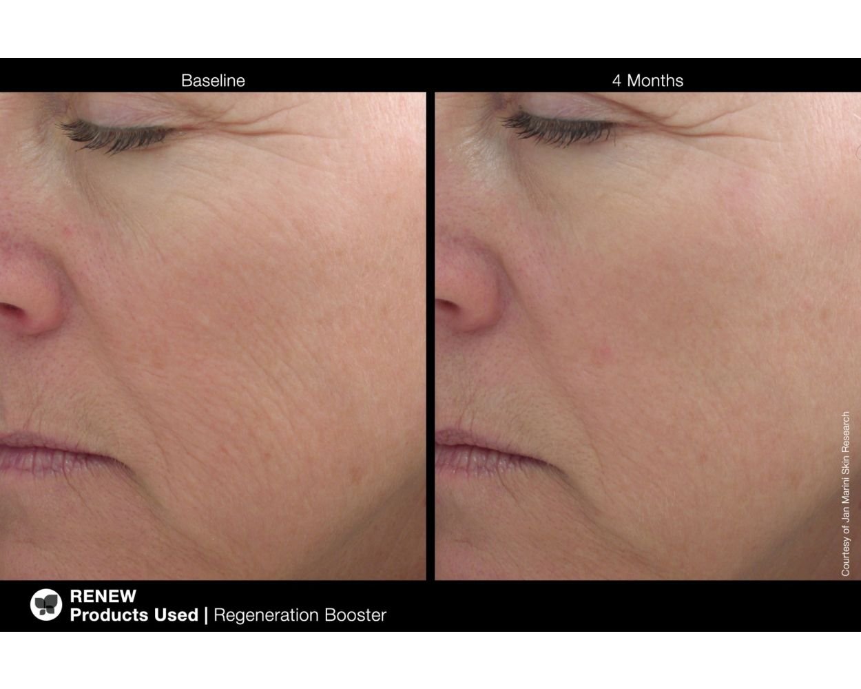 regenerationbooster_5_hd.jpg