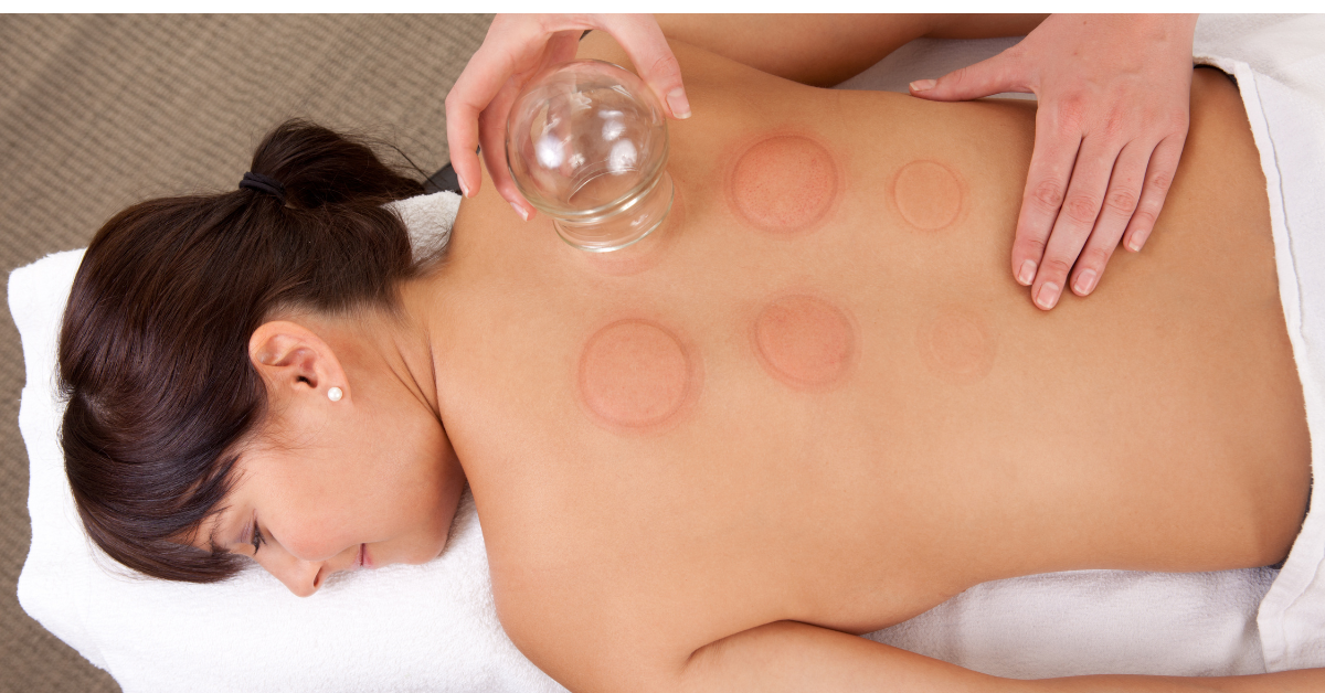 A therapist carefully applying a glass suction cup to a client's back during a professional spa treatment.