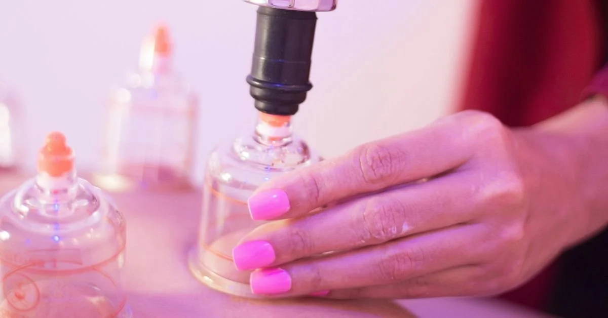 Close-up of a practitioner's hand using a manual suction pump to create a vacuum in a clear plastic cup on a patient's back.