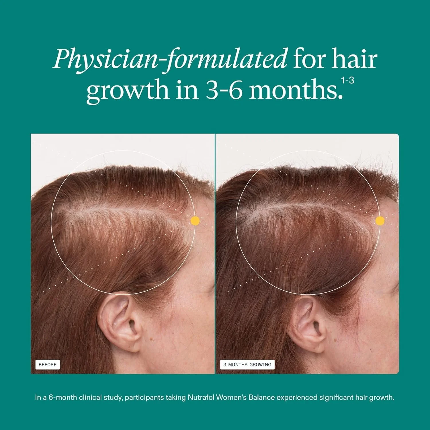 nutrafol balance pic 2.jpg