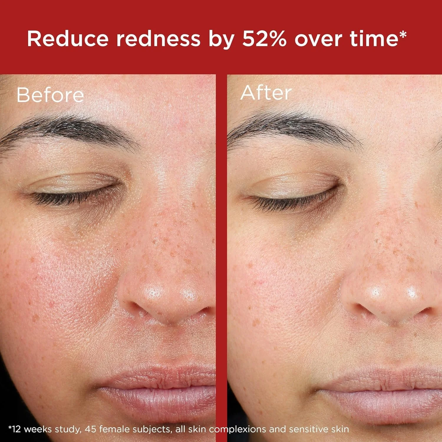 skin recovery green.jpg