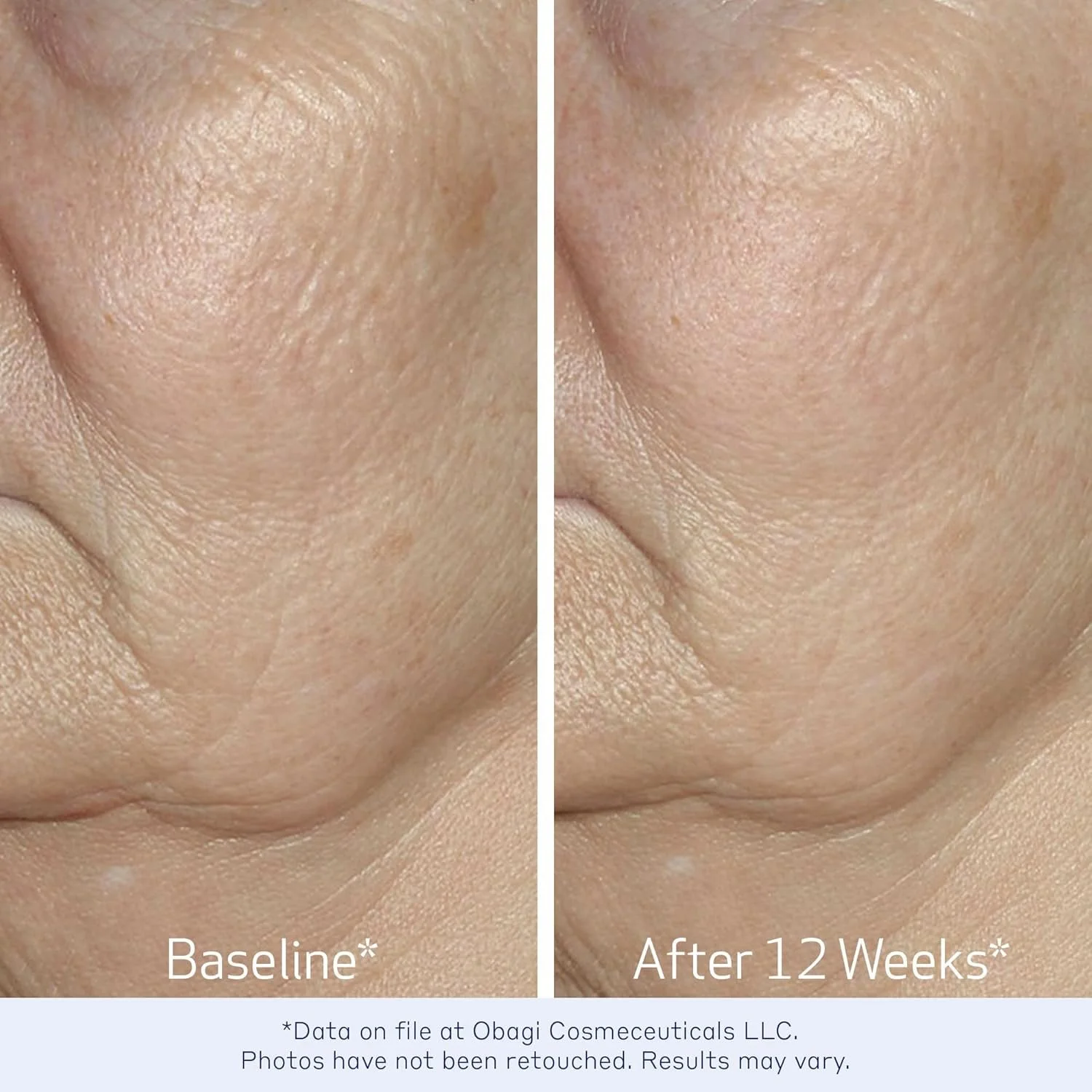 elastiderm facial serum 3.jpg