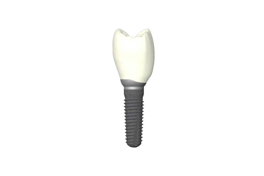 implantat-fezer.png