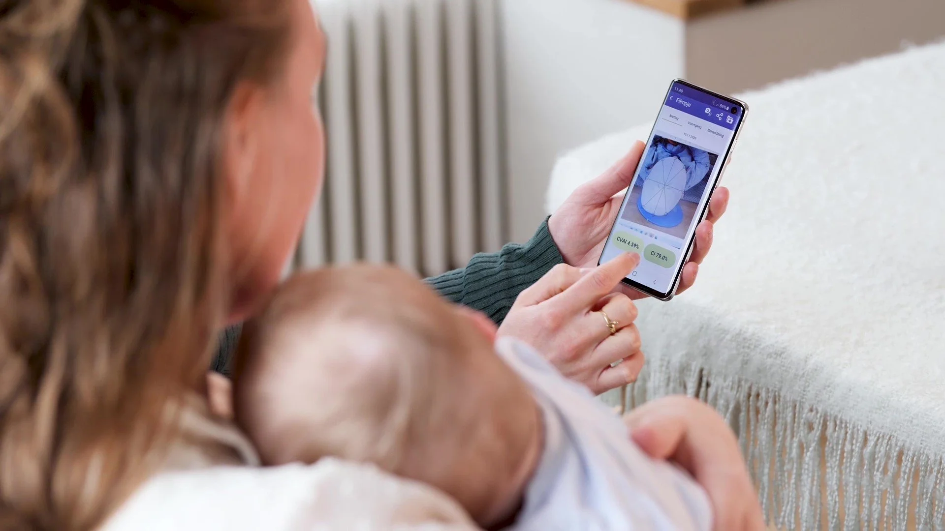 Gain Peace of Mind About Your Baby’s Head Shape—Right from Home