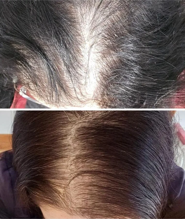 Before and after 4 months-female kirtland ohio
