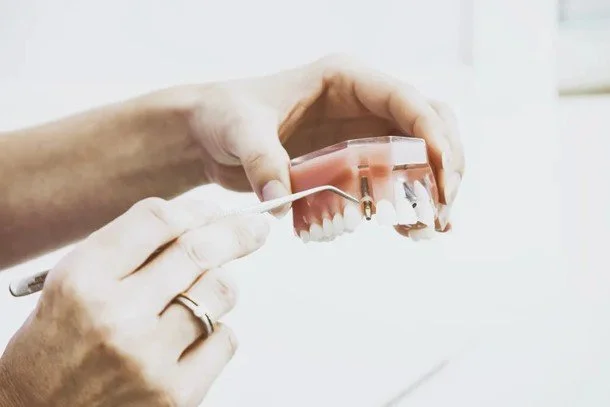 Why Do So Many Americans Choose All-on-4 Dental Implants in Tijuana, Mexico?