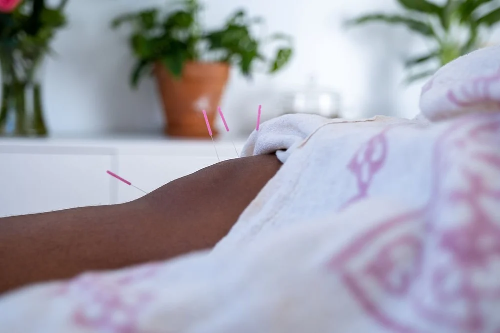 Acupuncture For Runner's Knee and Running Injuries — Emily Grace