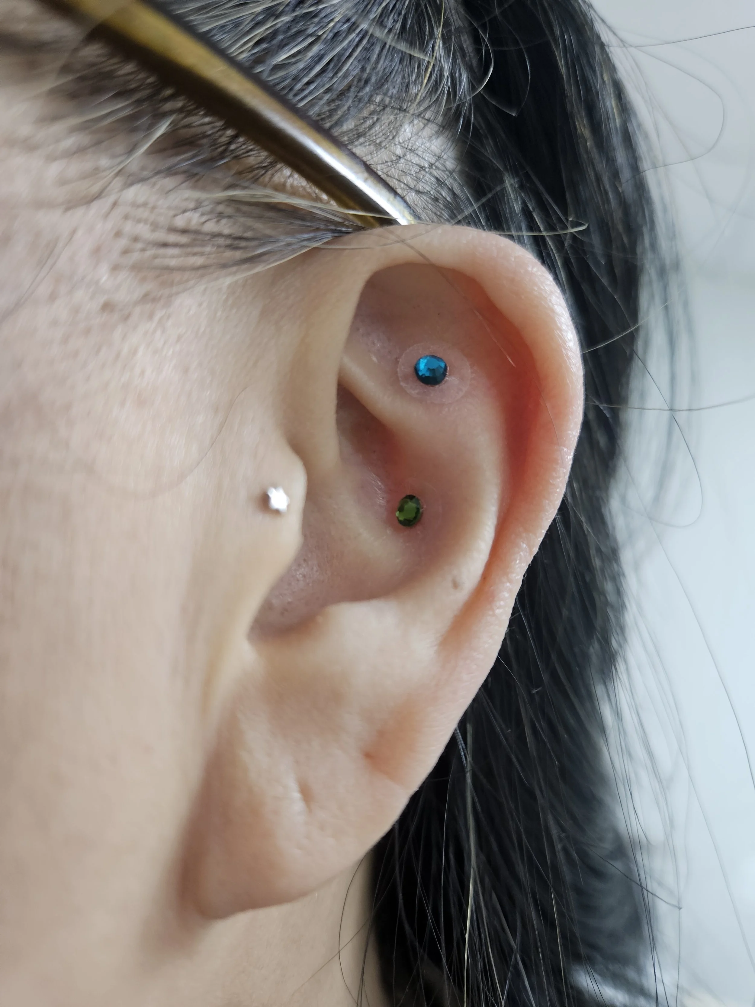 Trending Ear Seeds: Do They Really Work?