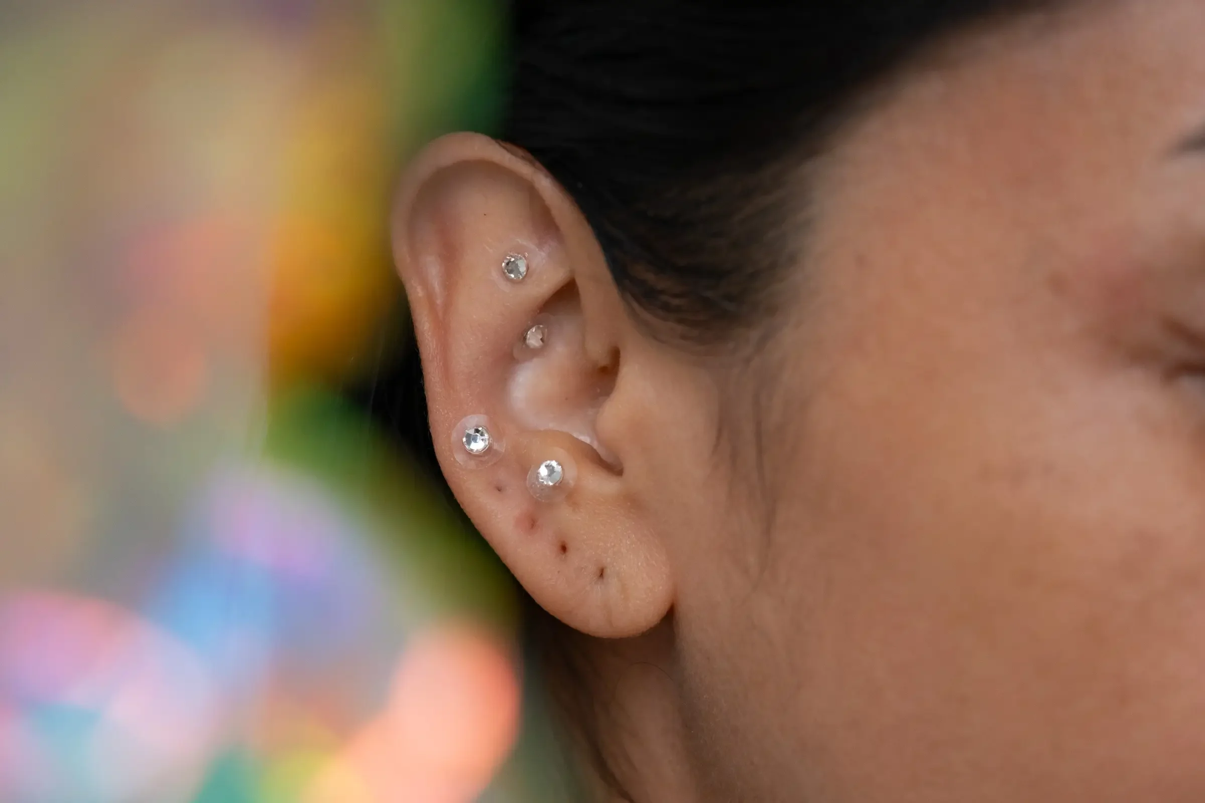 Close-up of a woman's pierced ear with auricular acupuncture, dark hair spread out, and a bouquet of small white flowers with green stems and a white ribbon in the background.