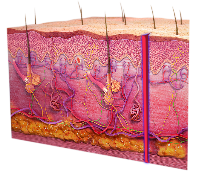 tissue matching