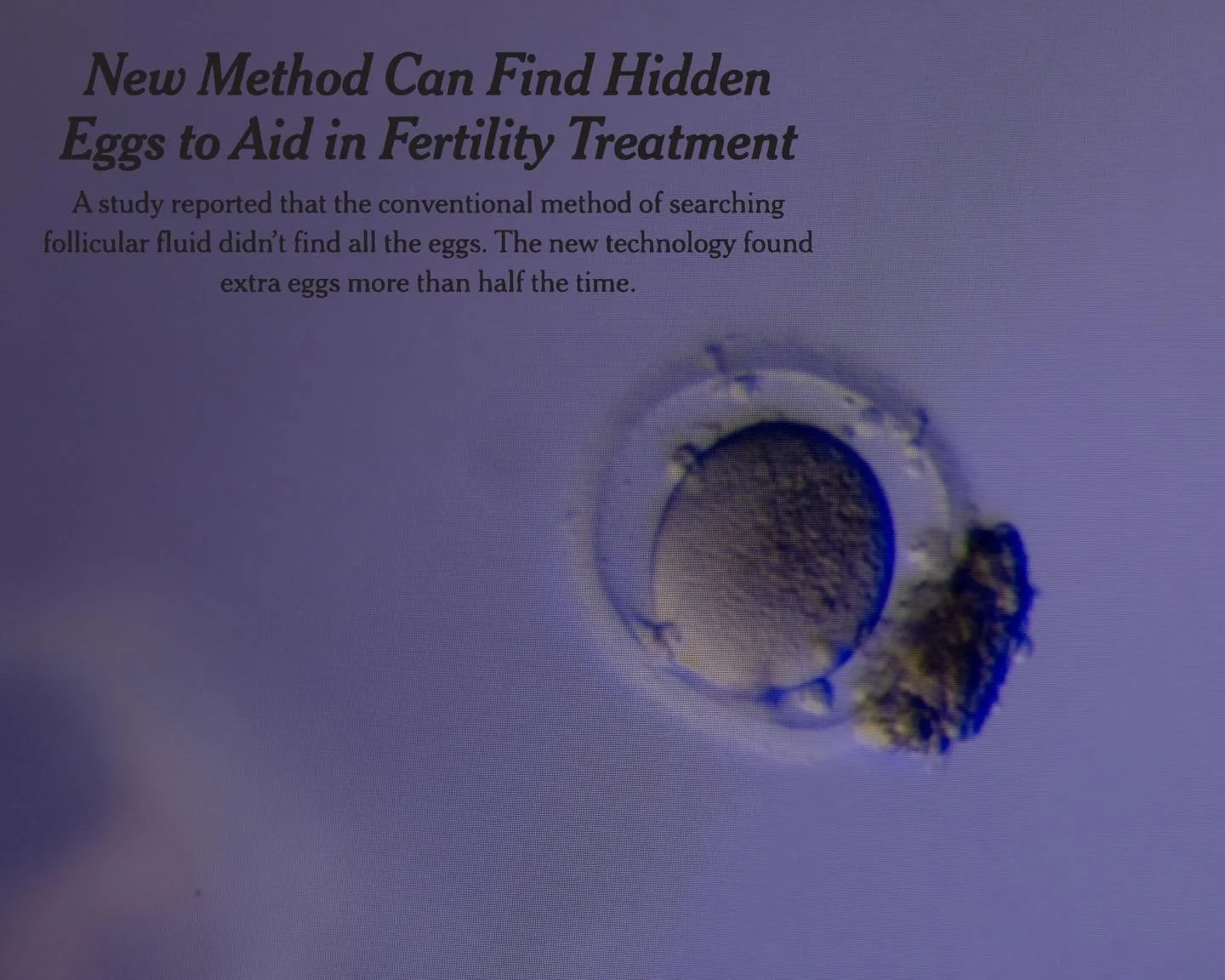 &ldquo;New Method Can Find Hidden Eggs to Aid in Fertility Treatment&rdquo; &mdash; written by Pam Belluck, for @nytimes 

Amazing to see this scientific process in action, and the difference it may make in the lives of so many couples trying to conc