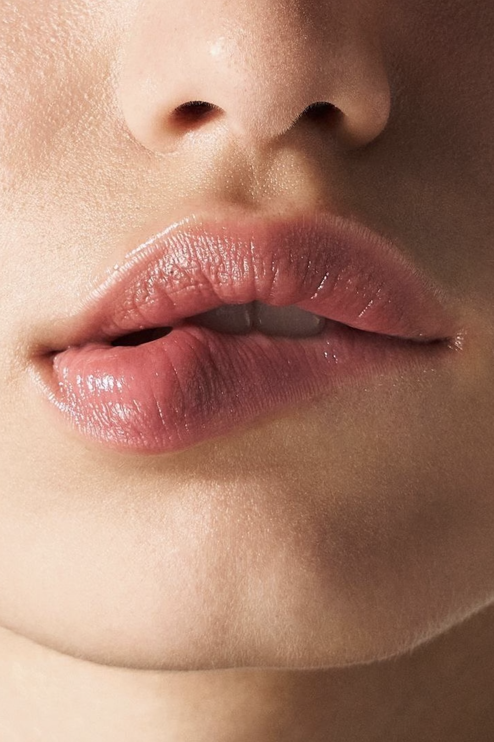 Perioral Dermatitis and Fluoride Toothpaste