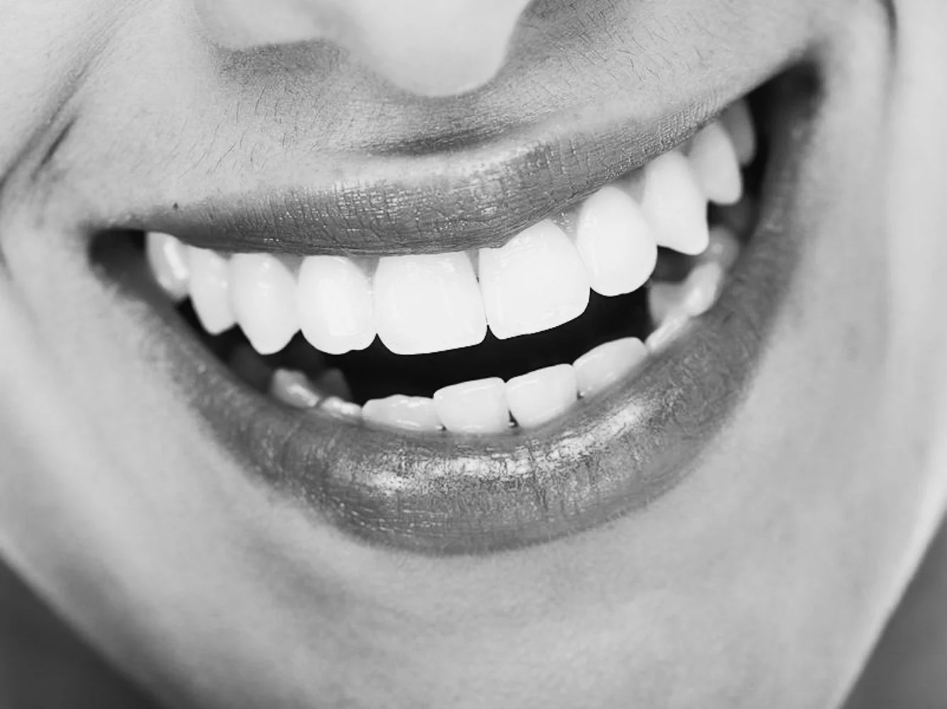 Hvordan skiller heklet tannregulering seg fra tradisjonelle bøyler?